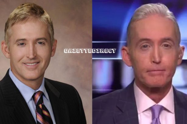 Trey Gowdy before and after nose job.