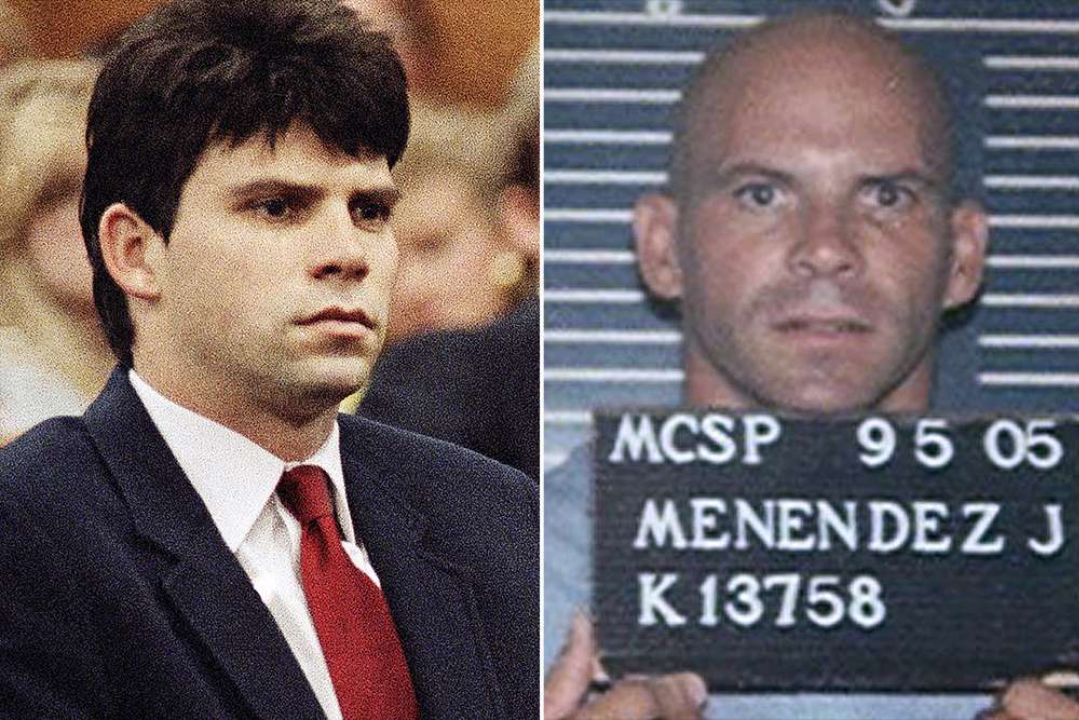 Lyle Menendez started using a wig to hide his bald head after losing hair in his teens.