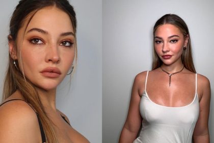 Does Madelyn Cline Have Lip Fillers? Before and After Plastic Surgery