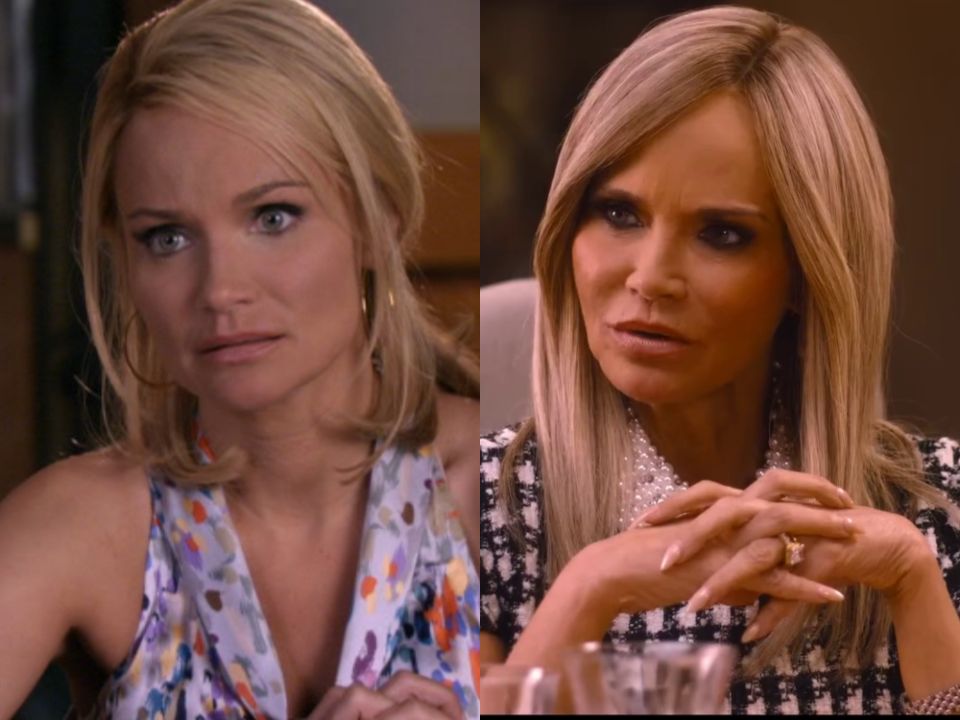 Kristin Chenoweth before and after plastic surgery, which includes Botox and fillers.