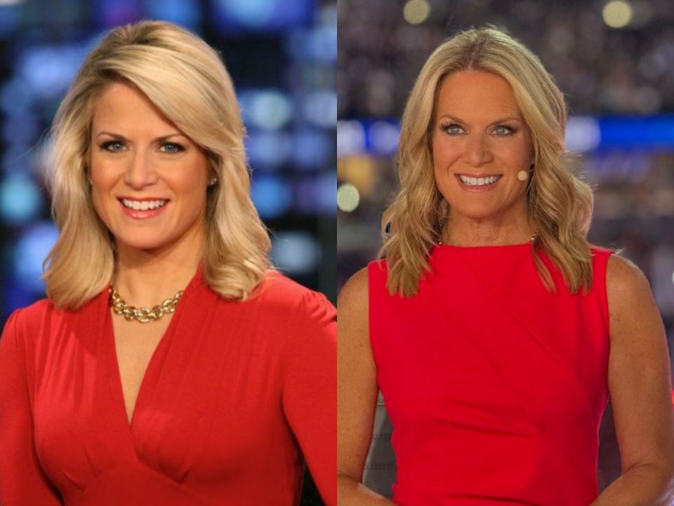 Martha MacCallum before and after plastic surgery.