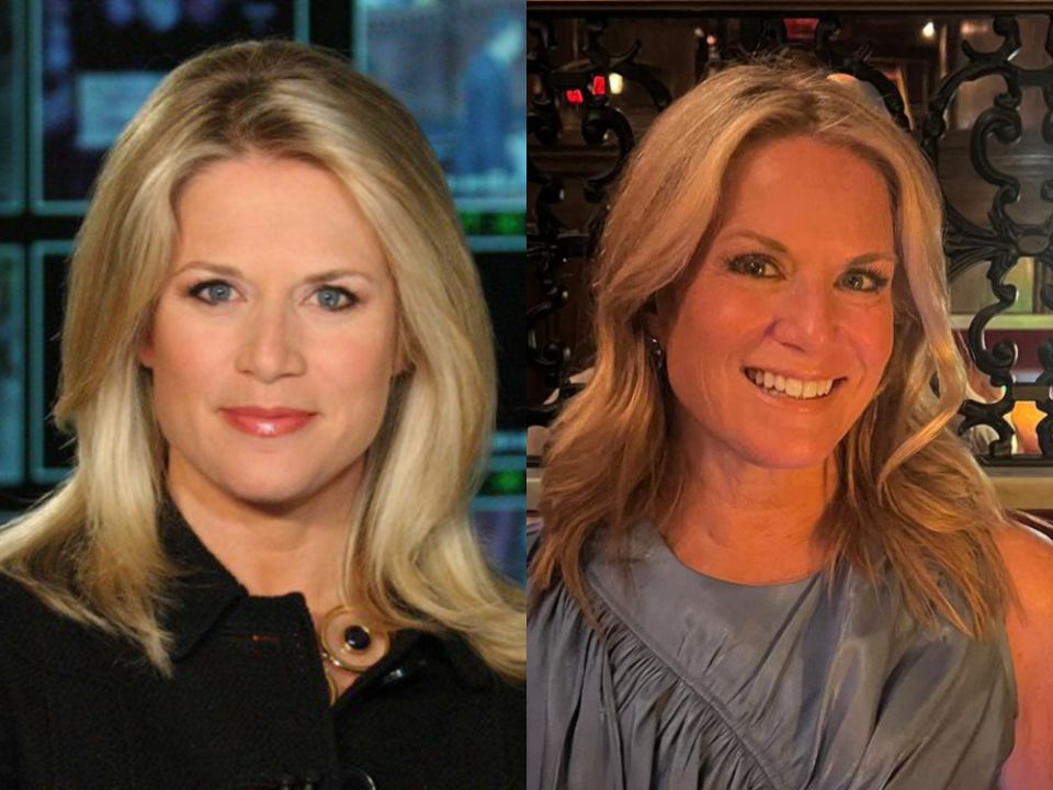 Martha MacCallum has likely had Botox, fillers, facelift, and eyelid surgery.