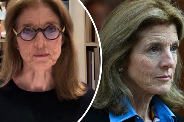 Caroline Kennedy Face Wrinkles: Health or Illness? Why Her Skin Looks Old