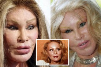 PHOTOS: ‘Catwoman’ Jocelyn Wildenstein Before Surgery Is Shocking