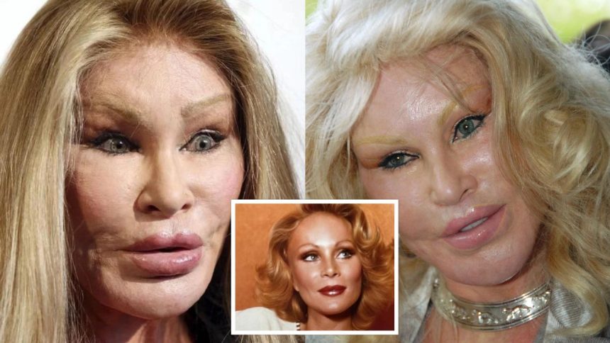 PHOTOS: ‘Catwoman’ Jocelyn Wildenstein Before Surgery Is Shocking