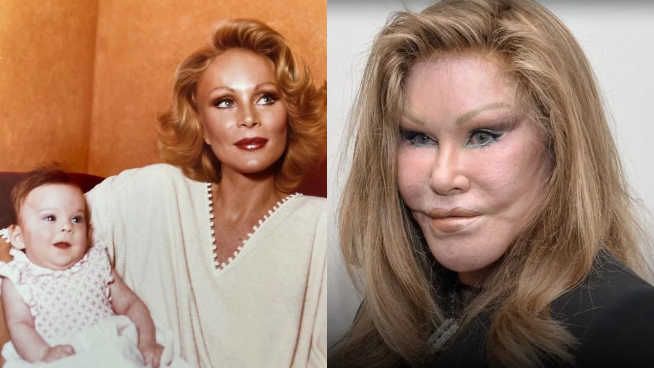 Jocelyn Wildenstein, “Catwoman,” is renowned for her dramatic before-and-after plastic surgery and cosmetic transformations.