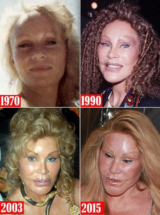 ‘Catwoman’ Jocelyn Wildenstein's changing appearance over the years.