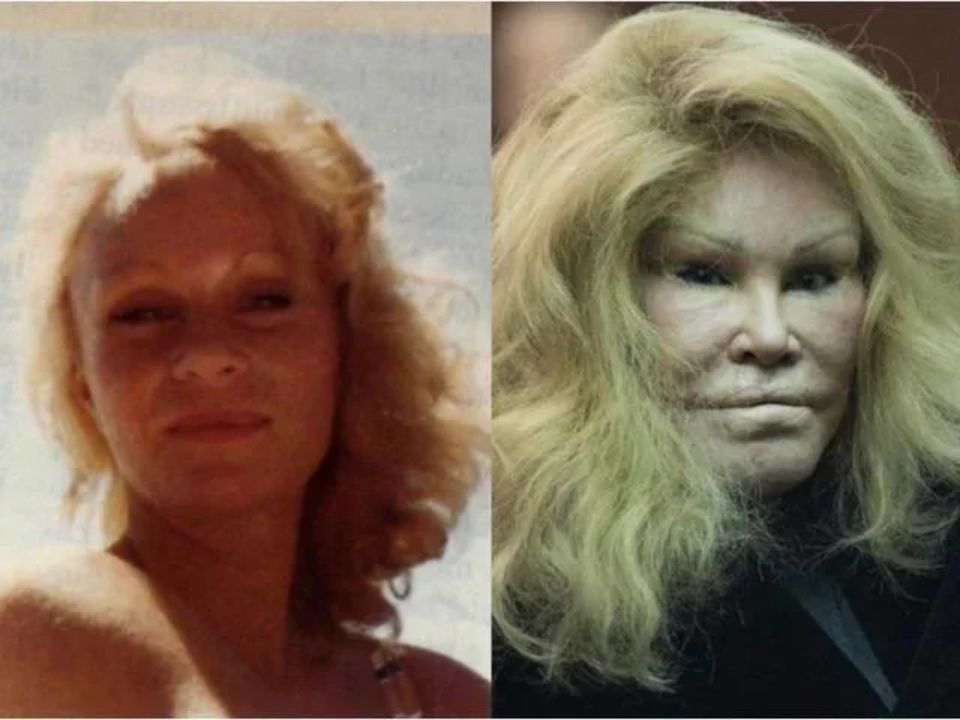 Jocelyn Wildenstein aka Catwoman looked vastly different in her young photos.