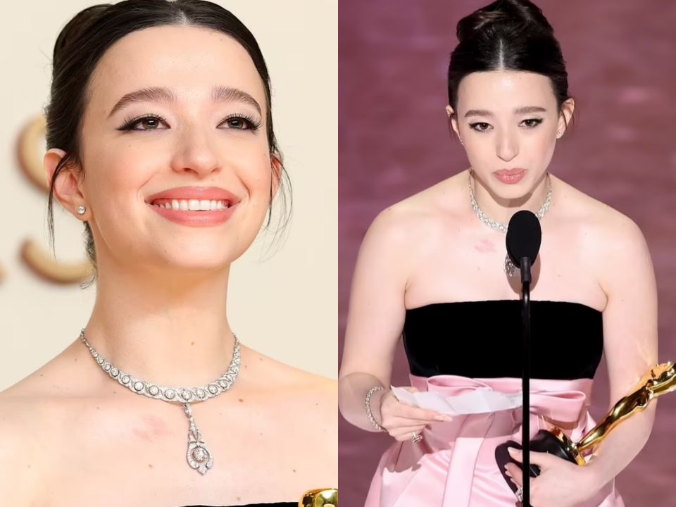 Mikey Madison's chest birthmark, often mistaken for a hickey or scar, gained attention after her Oscars win.