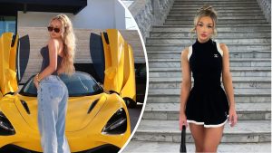 Vanna From Love Island: Before Plastic Surgery & Filler